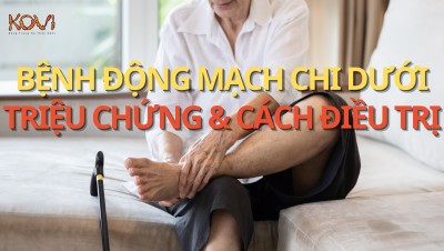 BỆNH ĐỘNG MẠCH CHI DƯỚI: TRIỆU CHỨNG VÀ CÁCH ĐIỀU TRỊ 