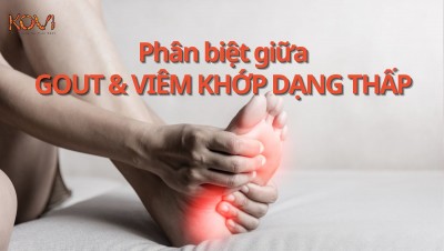 Hướng dẫn phân biệt gút và viêm khớp dạng thấp